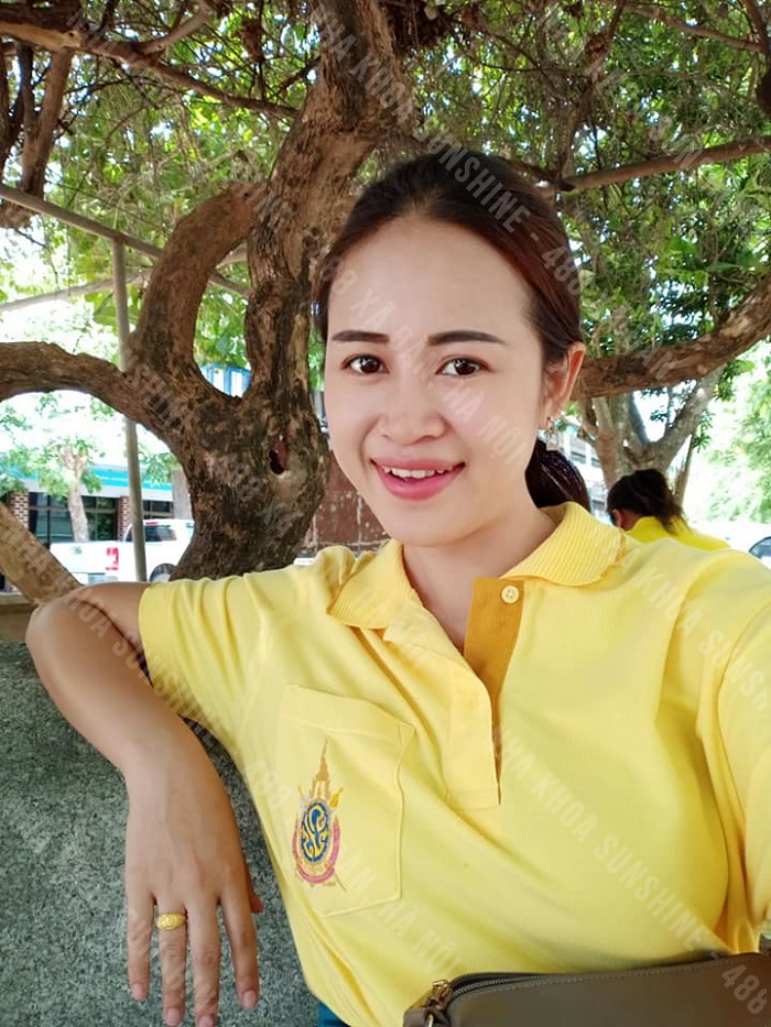 bọc răng sứ có bị đen lợi không bọc răng sứ có bị đen lợi không