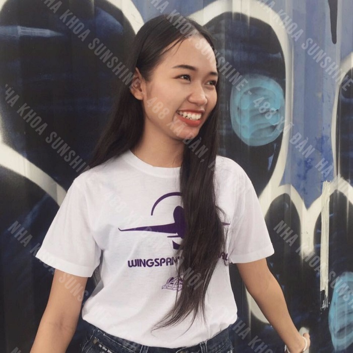 bọc răng sứ kim loại có bền không