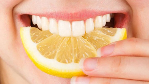 các loại răng sứ vita