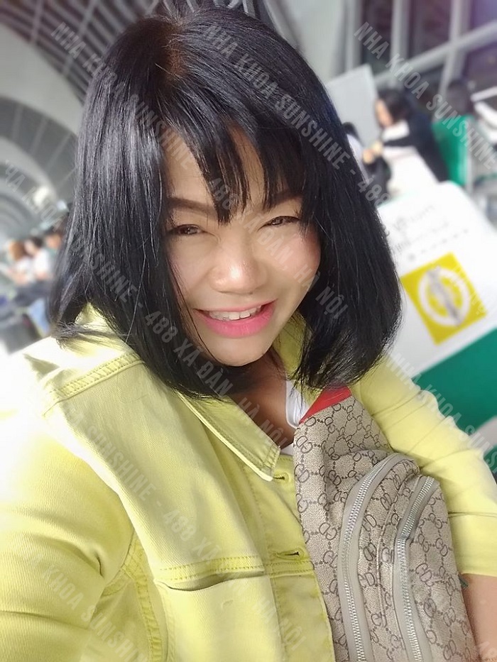 cách trồng răng khểnh