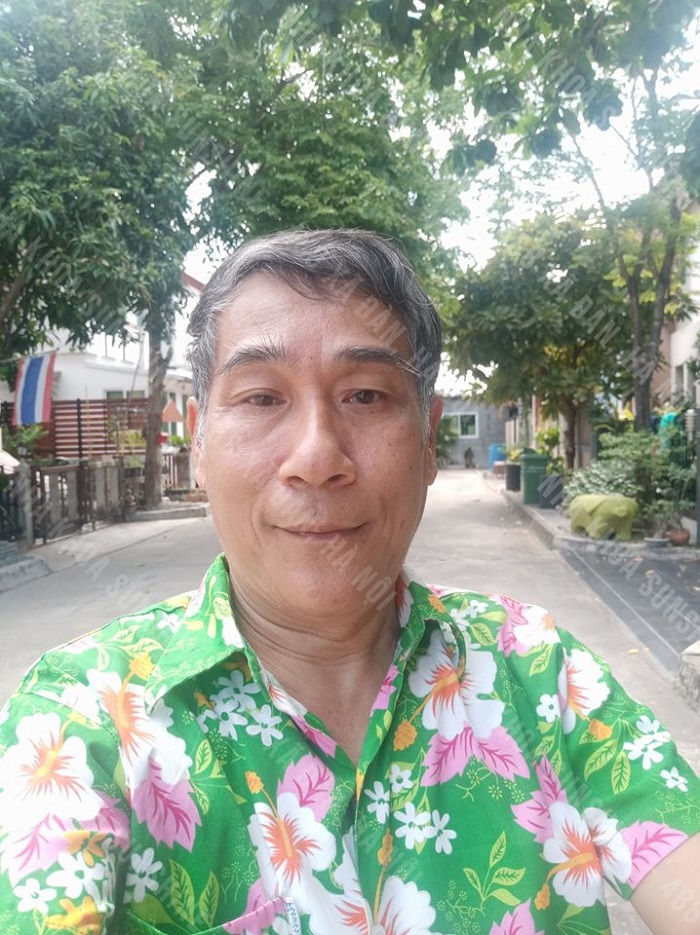 cấy ghép Implant bao lâu
