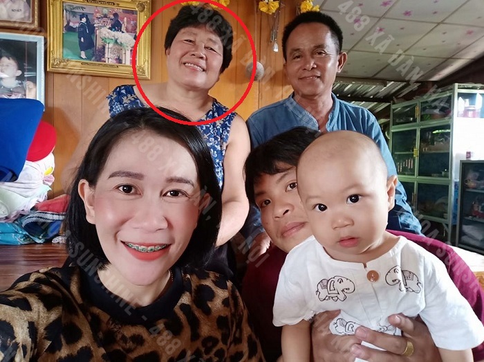 cấy ghép Implant có an toàn không