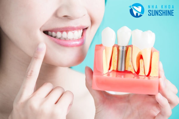 cấy ghép răng Implant là gì