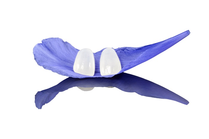 công nghệ phủ răng sứ ultra nano 3p