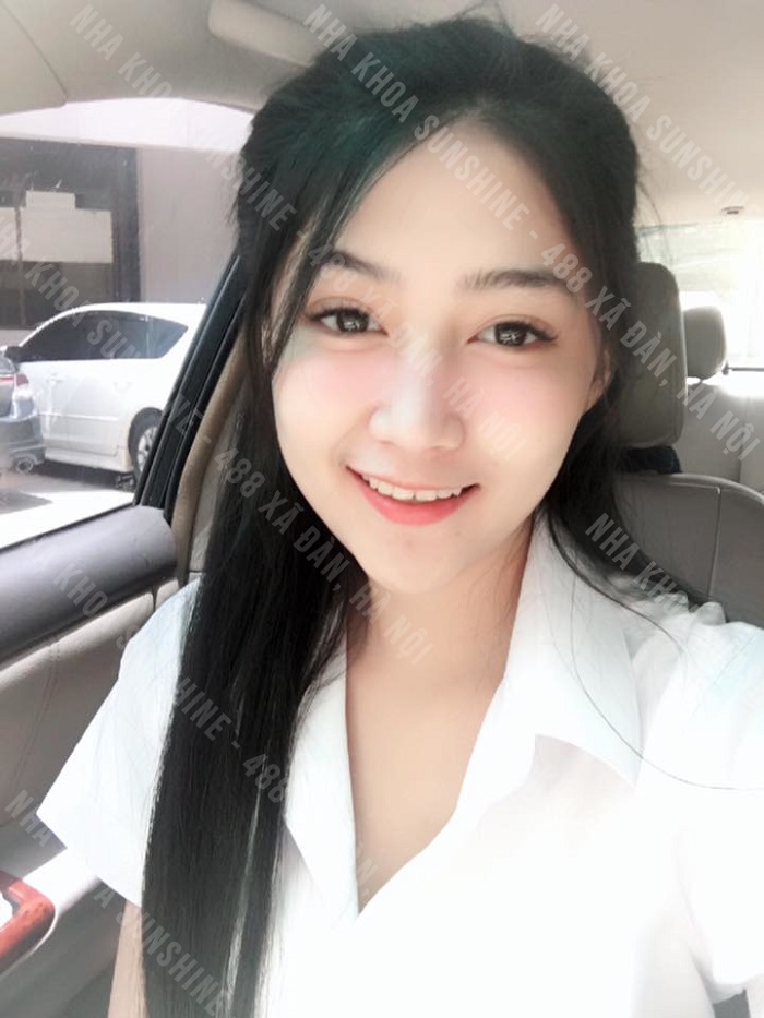 dán sứ veneer được bao lâu
