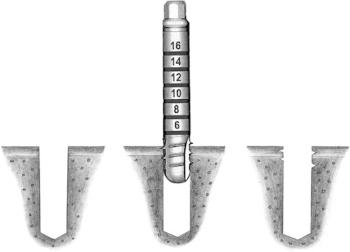 dụng cụ cấy ghép Implant dụng cụ cấy ghép Implant