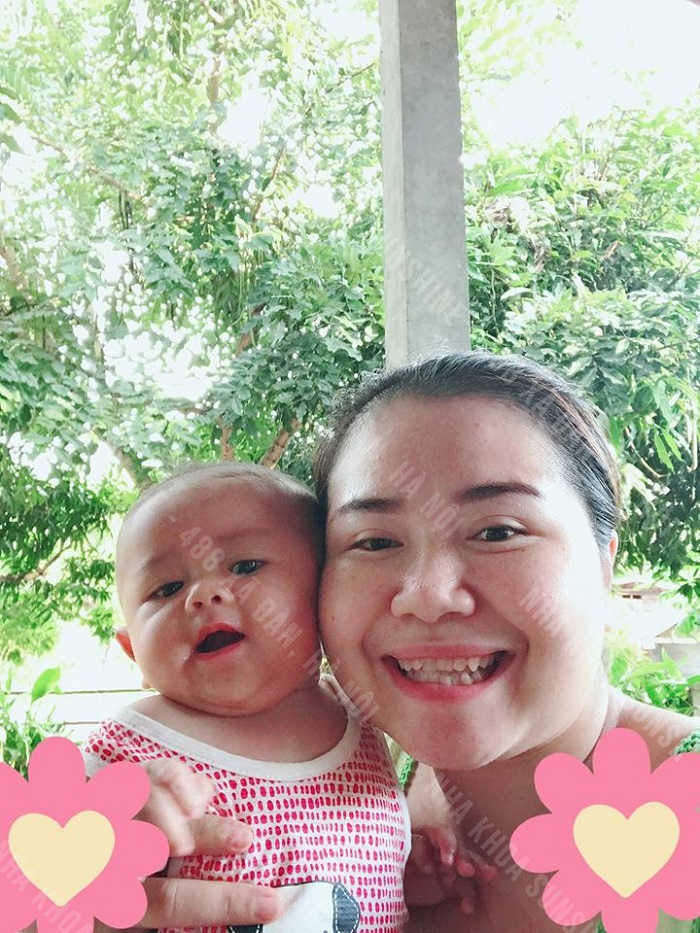 giá cả trồng răng sứ