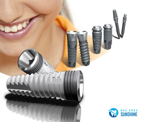 giá Implant Mỹ