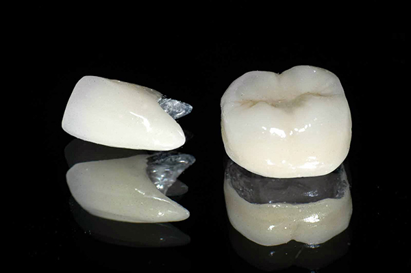 giá răng sứ kim loại Titan