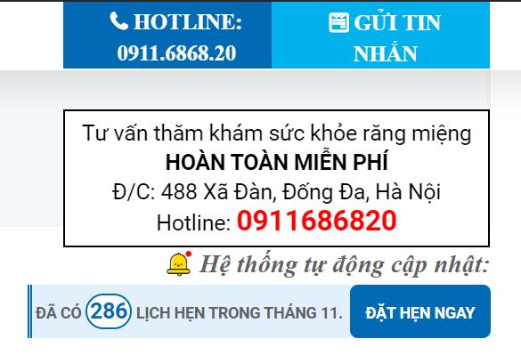 giá tiền trồng 1 cái răng