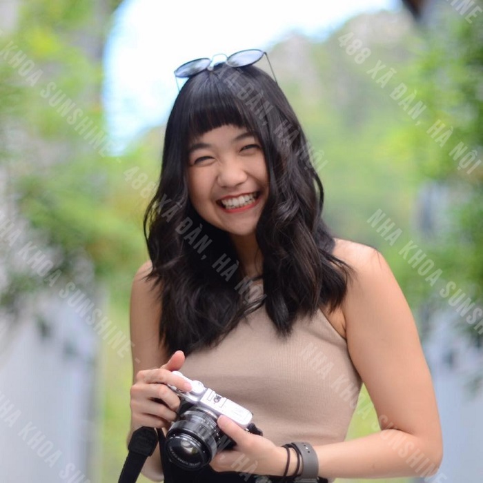 giá tiền trồng răng khểnh