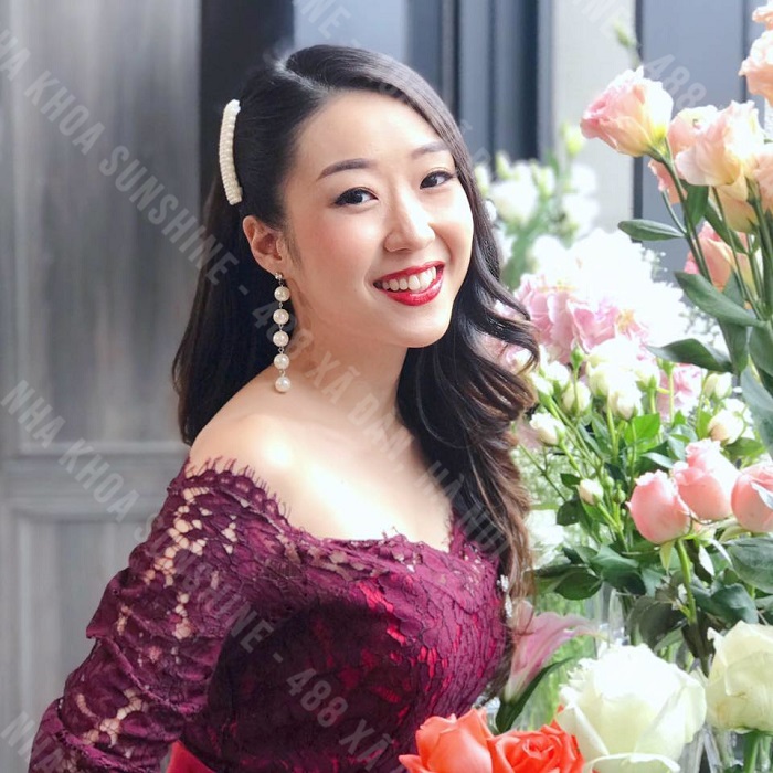 giá trồng răng bắc cầu