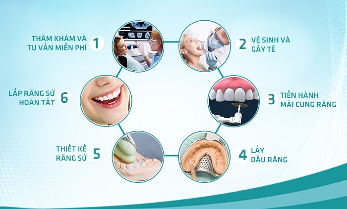 giá trồng răng giả nguyên hàm