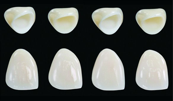 giá trồng răng hàm dưới