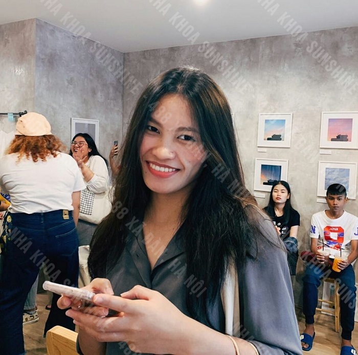 làm răng sứ bị tụt lợi
