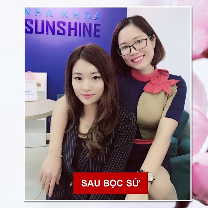 làm răng sứ có được bảo hiểm y tế không làm răng sứ có được bảo hiểm y tế không