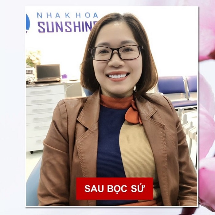 làm răng sứ có được bảo hiểm y tế không làm răng sứ có được bảo hiểm y tế không