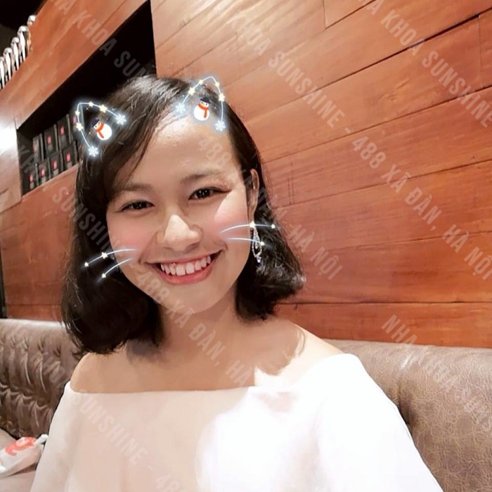 làm răng sứ ở đâu tốt