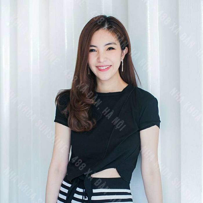 lợi ích của trồng răng sứ lợi ích của trồng răng sứ