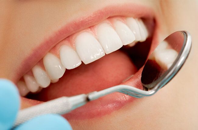nhổ răng bao lâu mới trồng răng sứ được
