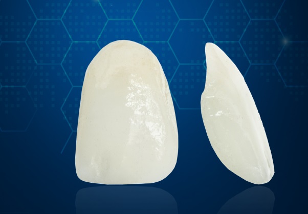 phủ răng sứ nano có bền không