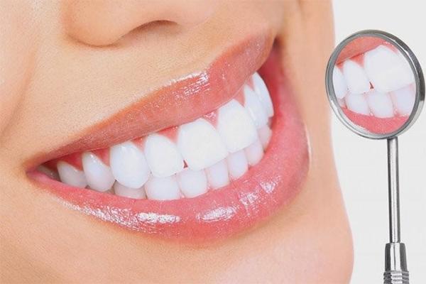 quy trình bọc răng sứ là gì