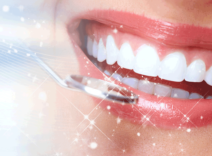 Tìm hiểu răng bọc sứ có tẩy trắng được không?