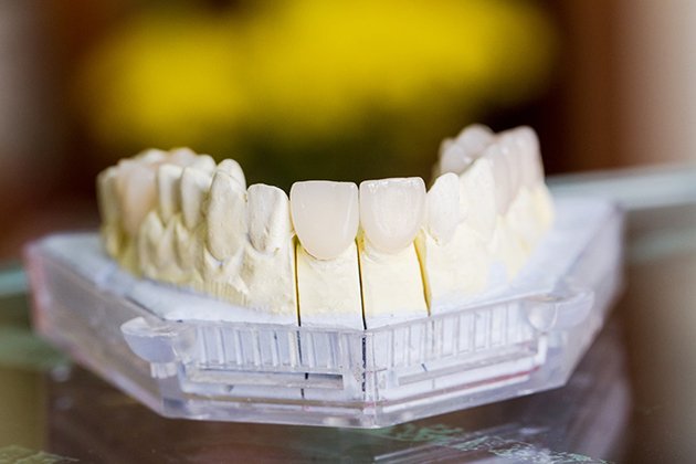 răng sứ zirconia 3d