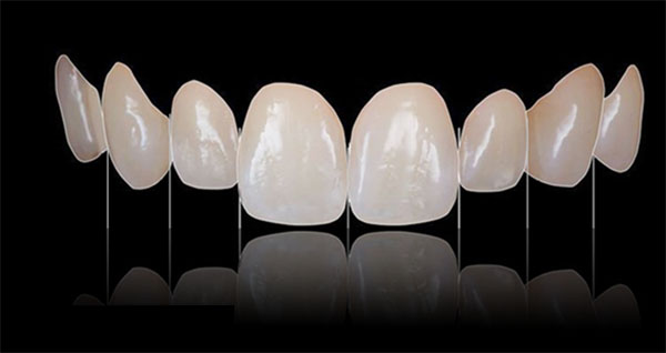 răng sứ zirconia là gì