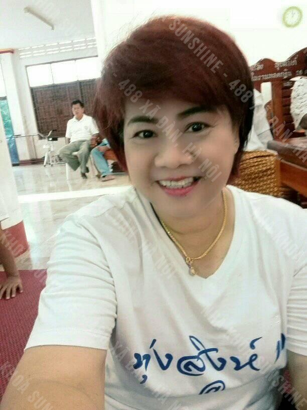 so sánh làm răng sứ với implant so sánh làm răng sứ với implant