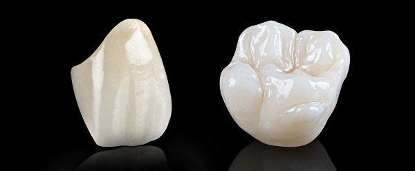 trồng 1 cái răng cửa bao nhiêu tiền trồng 1 cái răng cửa bao nhiêu tiền