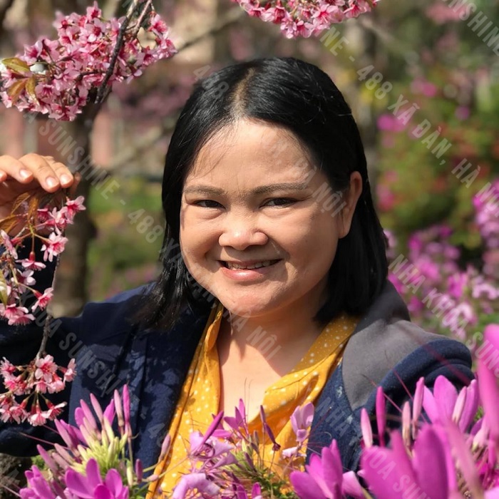trồng răng 2 hàm trồng răng 2 hàm