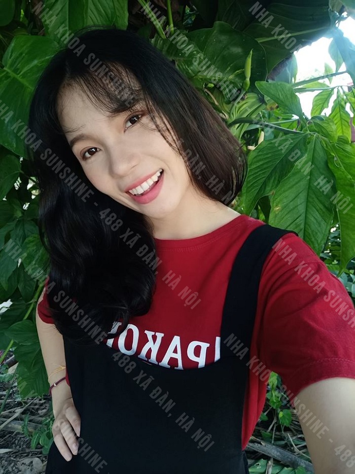 trồng răng bắc cầu bao nhiêu tiền trồng răng bắc cầu bao nhiêu tiền