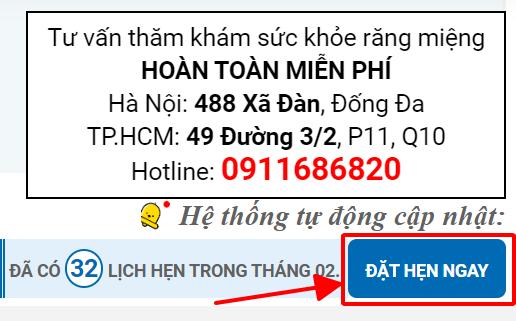 trồng răng cửa hàm trên giá bao nhiêu trồng răng cửa hàm trên giá bao nhiêu