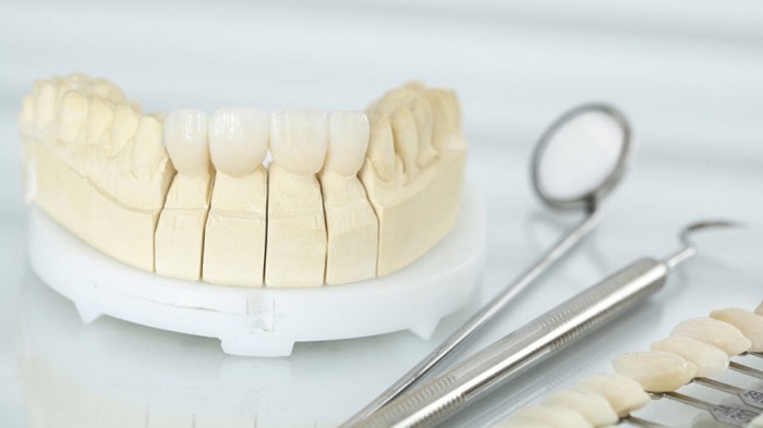 trồng răng cửa hàm trên giá bao nhiêu trồng răng cửa hàm trên giá bao nhiêu