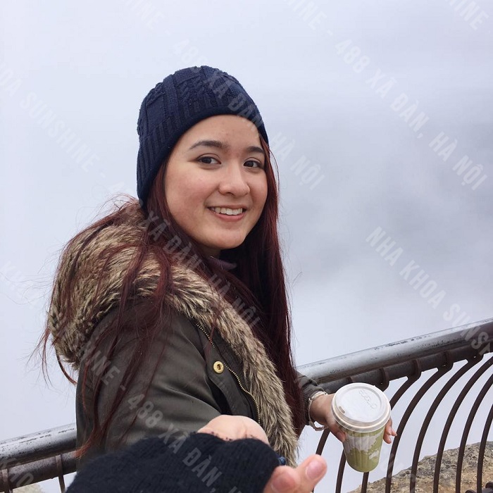 trồng răng cửa vĩnh viễn