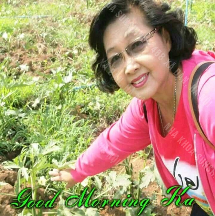 trồng răng giả được bao lâu trồng răng giả được bao lâu