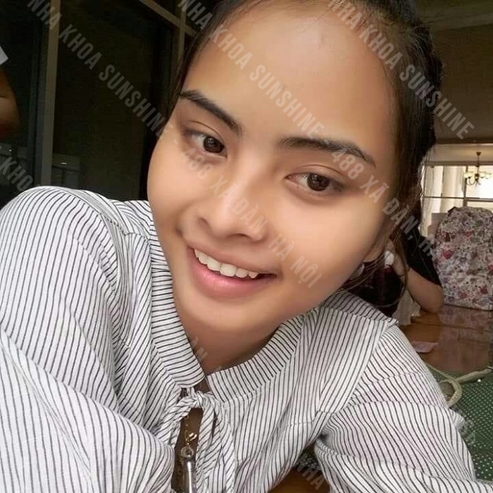 trồng răng hàm có đau không