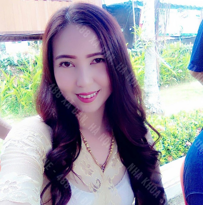 trồng răng hàm hết bao nhiêu tiền