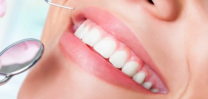 trồng răng hàm số 6 giá bao nhiêu