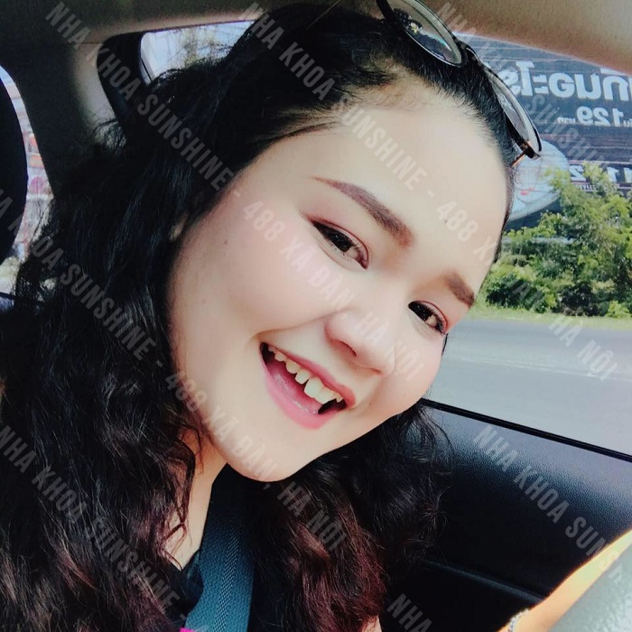 trồng răng hết bao nhiêu tiền trồng răng hết bao nhiêu tiền