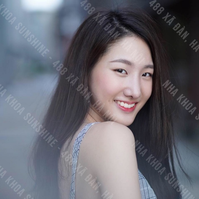 trồng răng khểnh hết bao nhiêu tiền