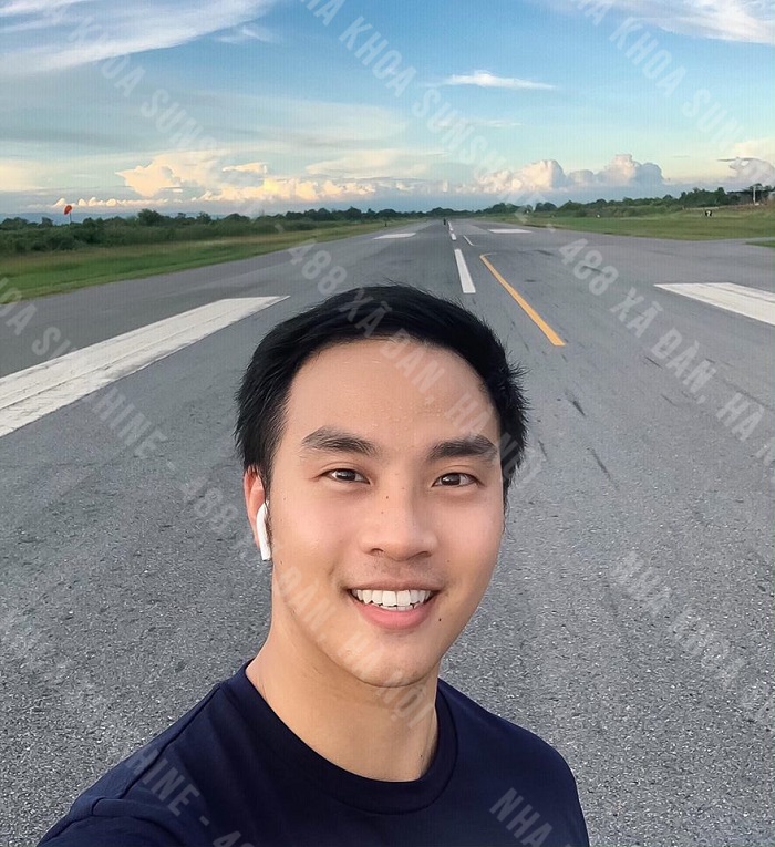 trồng răng khểnh nam trồng răng khểnh nam