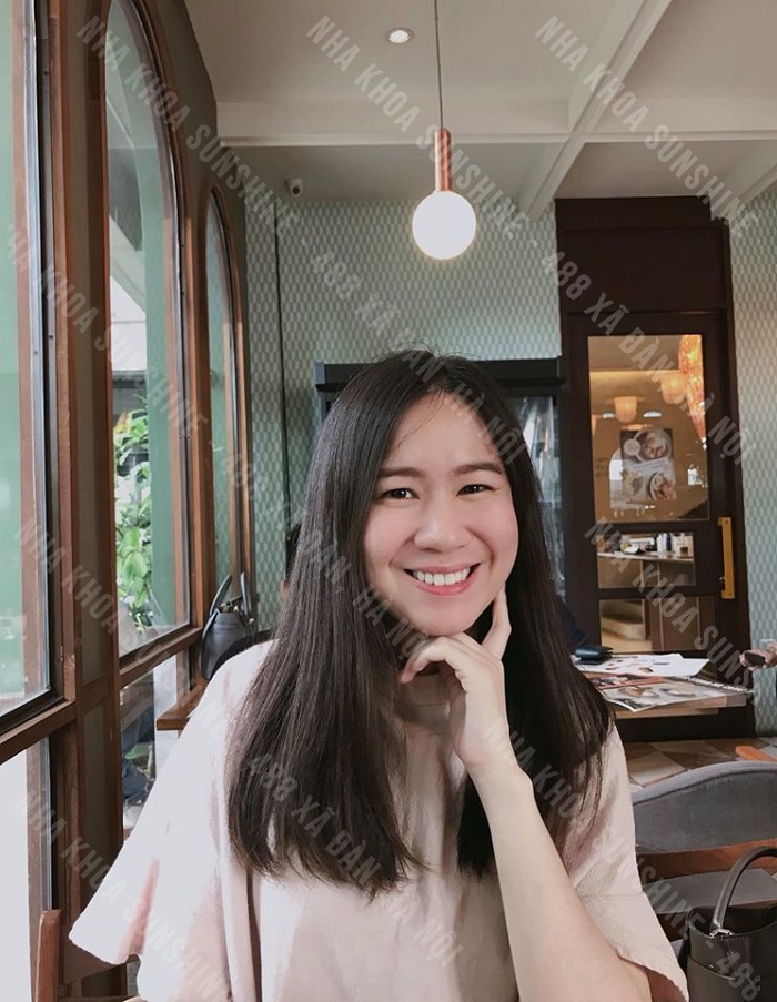 trồng răng khểnh như thế nào trồng răng khểnh như thế nào