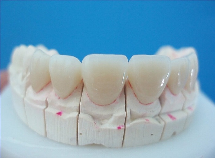 trồng răng sứ giá rẻ tphcm