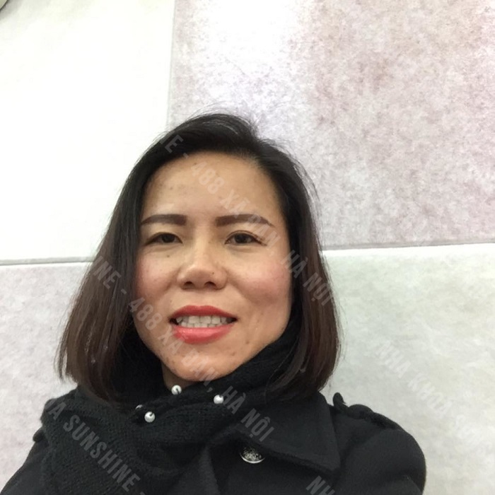 trồng răng sứ mất thời gian bao lâu