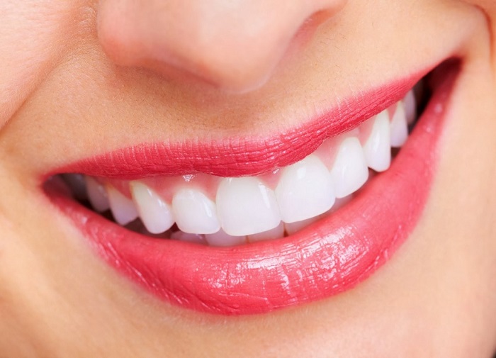 ưu điểm của răng sứ cercon
