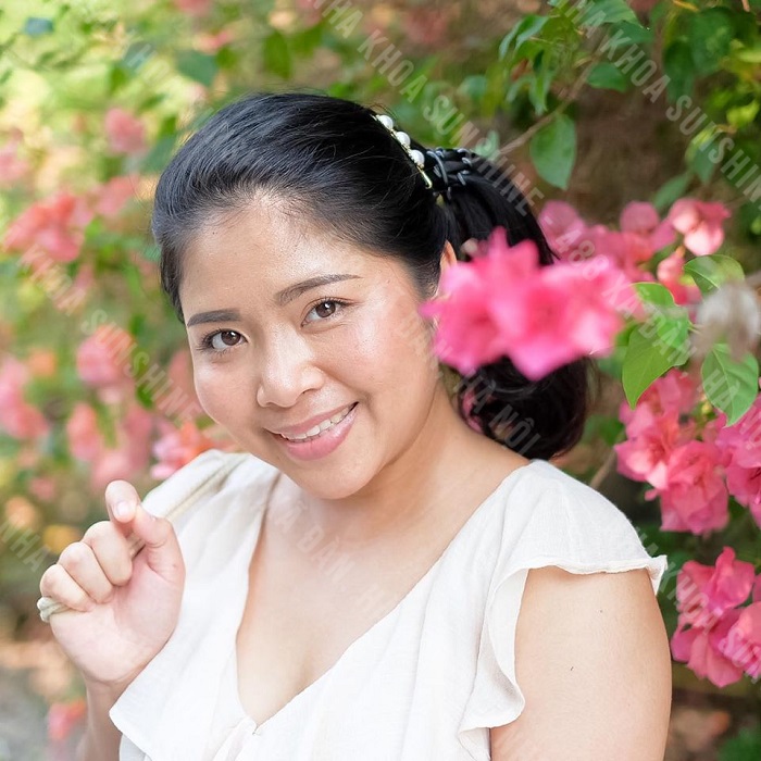 có mấy loại dây cung trong niềng răng