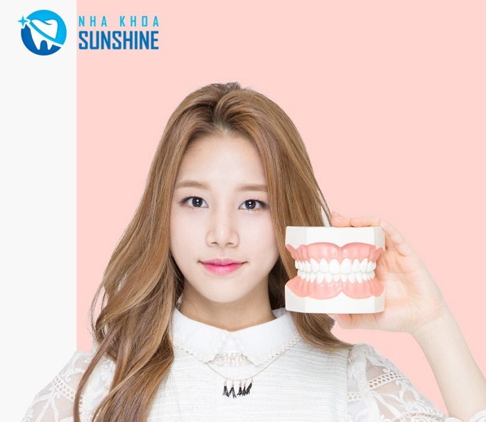có nên niềng răng mắc cài sứ không có nên niềng răng mắc cài sứ không