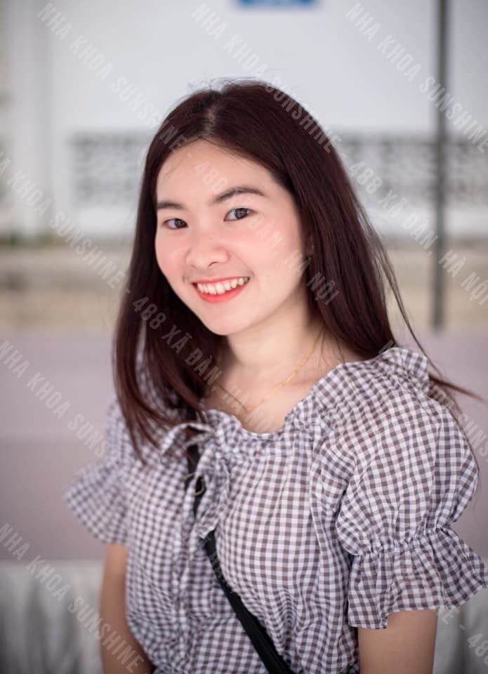 giá trồng răng giả Implant giá trồng răng giả Implant